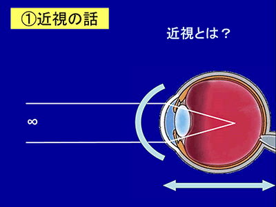 近視とは？